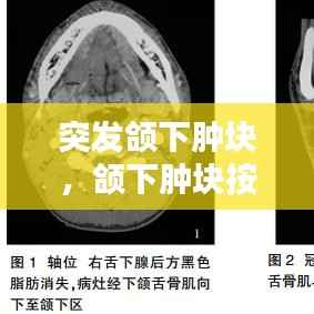 突发颌下肿块,颌下肿块按压疼