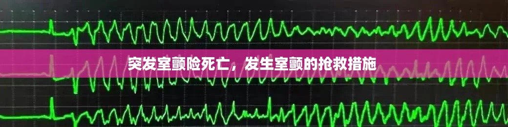 突发室颤险死亡,发生室颤的抢救措施